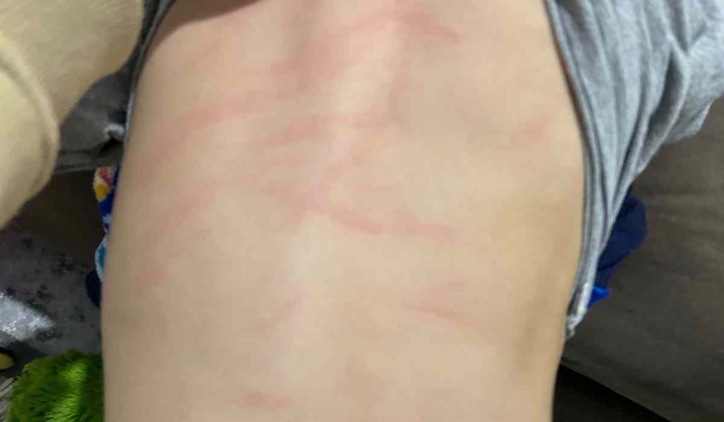 agressão a criança em creche de Juiz de Fora foi denunciada
