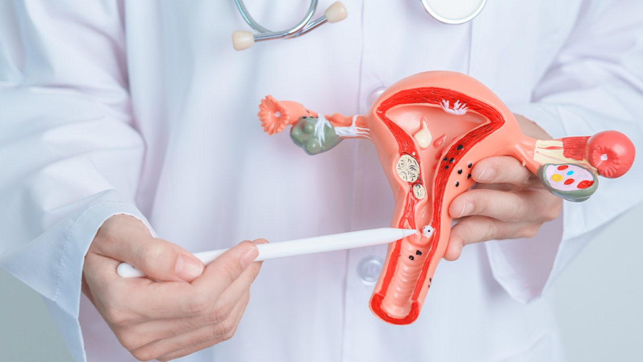 Juiz de Fora tecnologia cancer colo utero