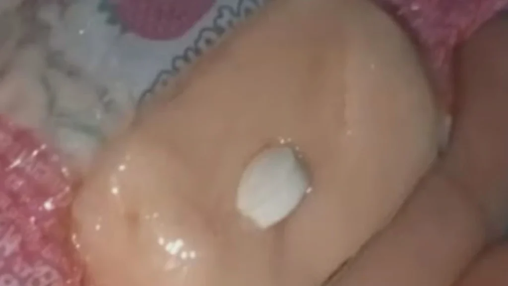 Criança passa mal após comer bala distribuída por “Papai Noel” em Minas Gerais 5 bala crianca natal