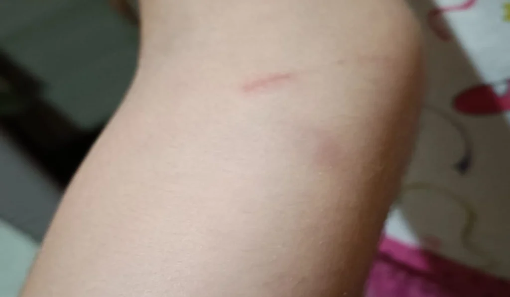 Criança portadora de autismo agredida em escola municipal de juiz de fora