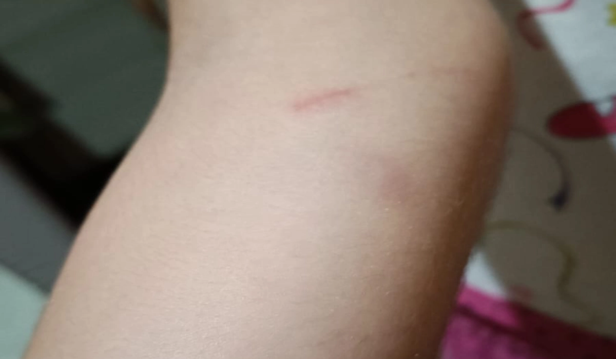 Criança portadora de autismo agredida em escola municipal de juiz de fora