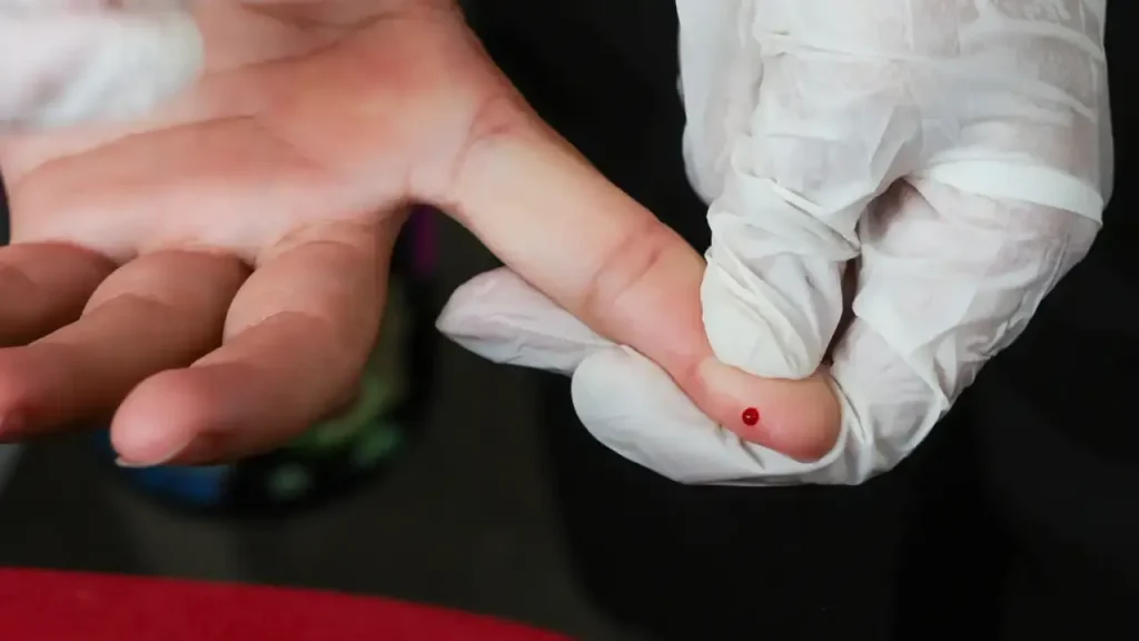 Teste rápido de dengue passa a ser oferecido gratuitamente pelo SUS em unidades de saúde