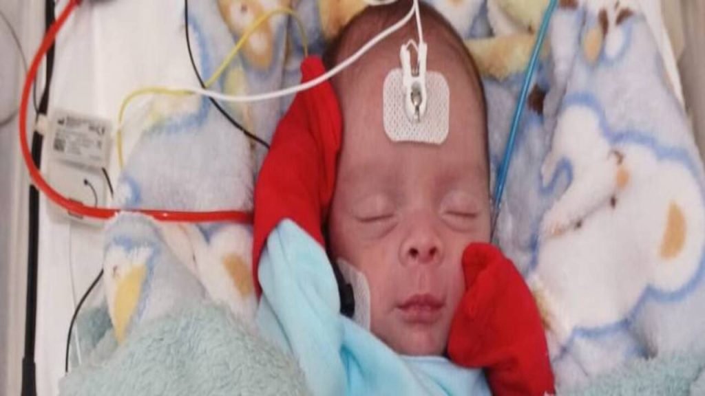 Hospital João Penido moderniza triagem auditiva neonatal e amplia atendimento em Juiz de Fora 5 Hospital João Penido moderniza triagem auditiva neonatal e amplia atendimento em Juiz de Fora