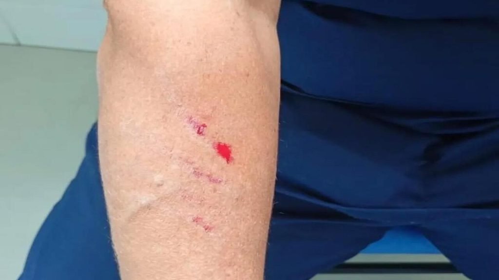 Profissionais da saúde protestam por mais segurança após série de agressões em Juiz de Fora 8 Profissionais da saúde protestam por mais segurança após série de agressões em Juiz de Fora